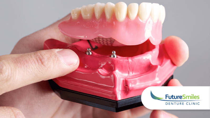 How Do Oral Surgeons and Denturists Work Together For Dental Implants